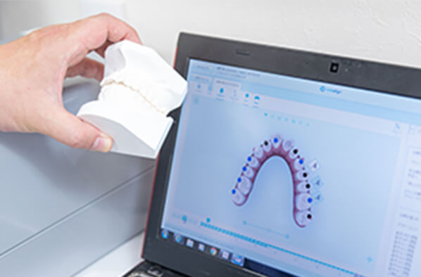 歯列模型検査