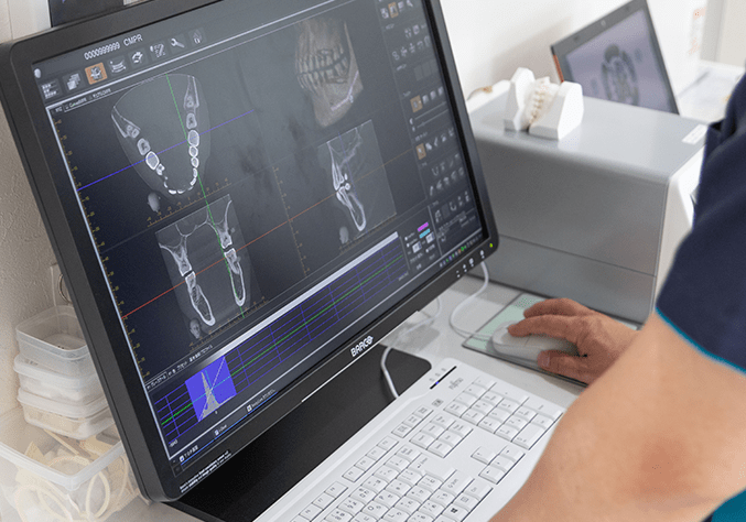 顎運動の力点を精密検査で検証
